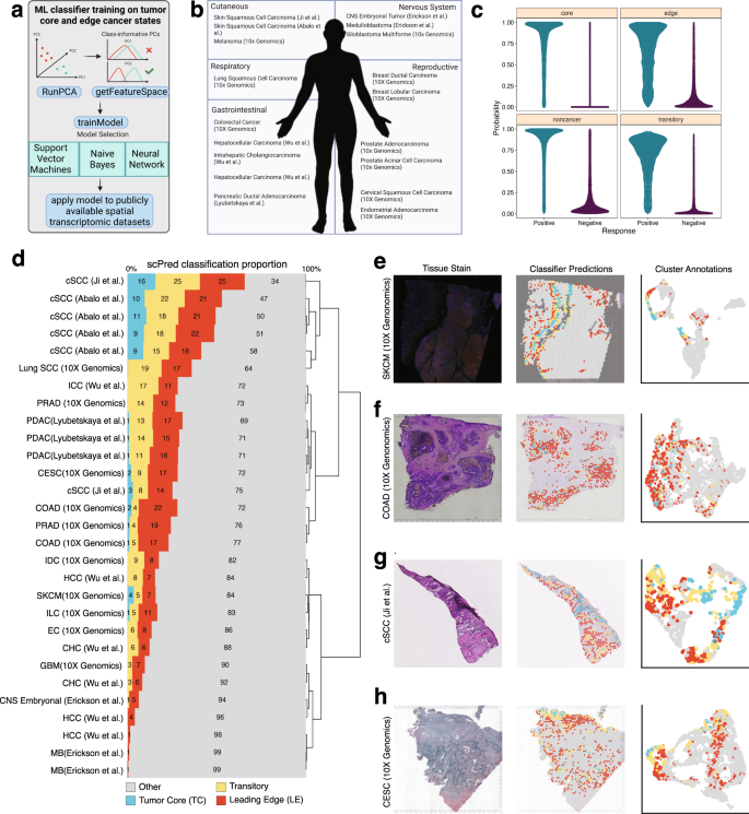 Clinical outcome predictions from spatial signatures