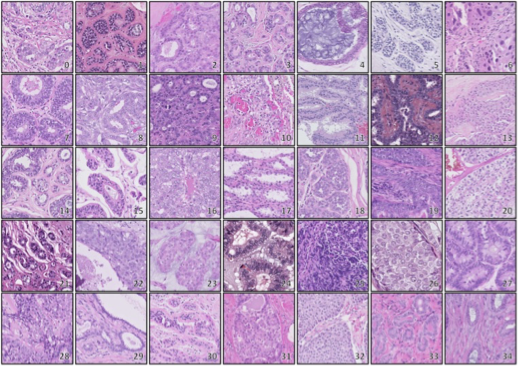 Figure 2: Pathology Slide Uniformity
