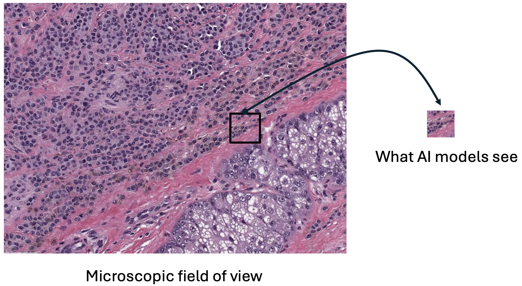 Domain shift failures across institutional boundaries
